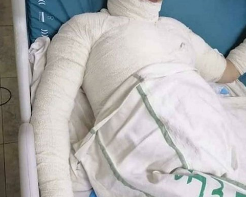 الأردن: زوج يحرق زوجته في سحاب 